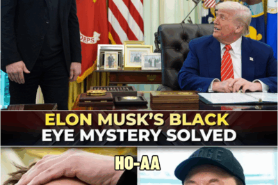 X marks the spot: Bruised Musk says his young son punched him | HO