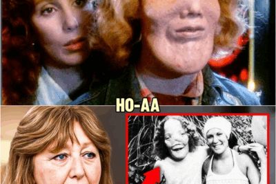 Before She Died, Rocky Dennis’s Mom FINALLY Broke Silence About Rocky Dennis And It’s Not Good | HO!!