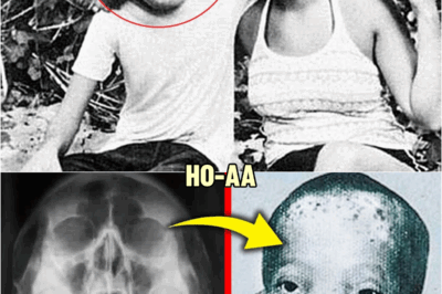 Experts Study Old Medical Scans of Rocky Dennis From 1960s.. They Zoom In And Instantly Turn Pale | HO!!