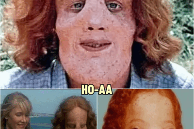 Mask – Heartbreaking Tragedy Of Rocky Dennis From ‘Mask’ | HO