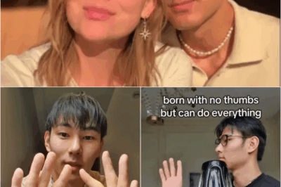 s – No thumbs, no problem. I was born without thumbs — but people are amazed at what I can do without them