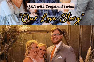 S – Conjoined Twins Share Their Love Story & How They Beat The Odds! Answering Your Burning Questions(𝗩𝗜𝗗𝗘𝗢)👀