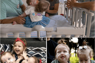S – Mom recalls her conjoined twins’ risky separation surgery