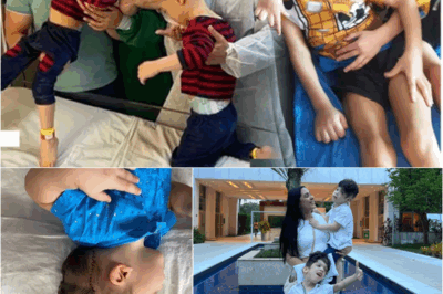 S – TWINCREDIBLE My conjoined twins never saw each other for YEARS after being born joined at head… they still feel each other’s emotions