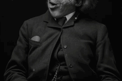 The Surprising, Sad, And True Story Behind ‘The Elephant Man’ | HO!!