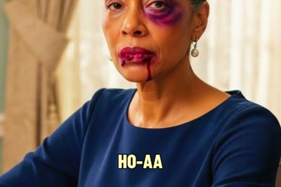 My husband bruised my face. The next morning, I served him breakfast he never expected… | HO