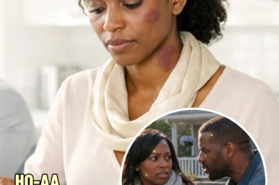 Her Husband Bruised Her Face — The Next Morning, She Served Him A Breakfast He Never Expected… | HO”